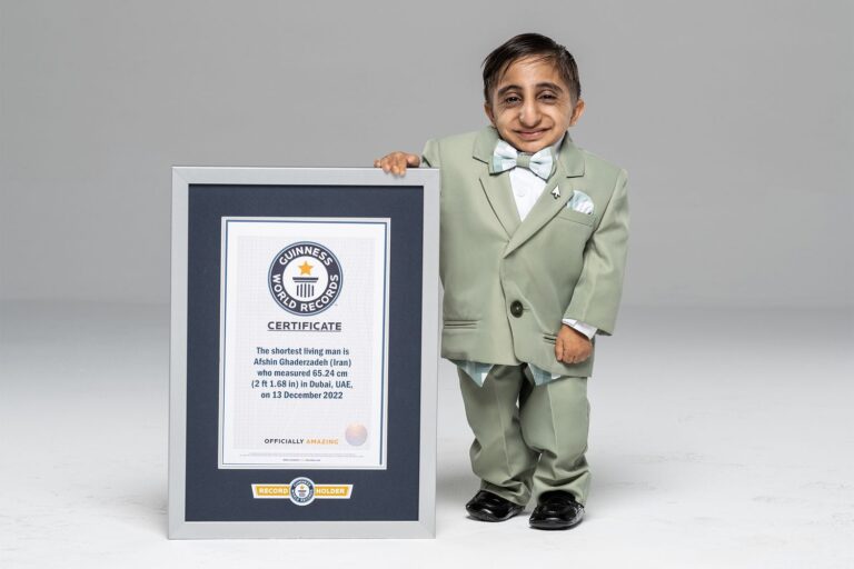 Meet the world's smallest person, you will be shocked to know his height