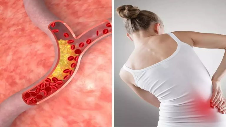 When cholesterol levels rise in the body these symptoms can be costly to ignore