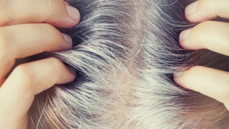 Hair turns gray before age? This recipe will blacken the roots